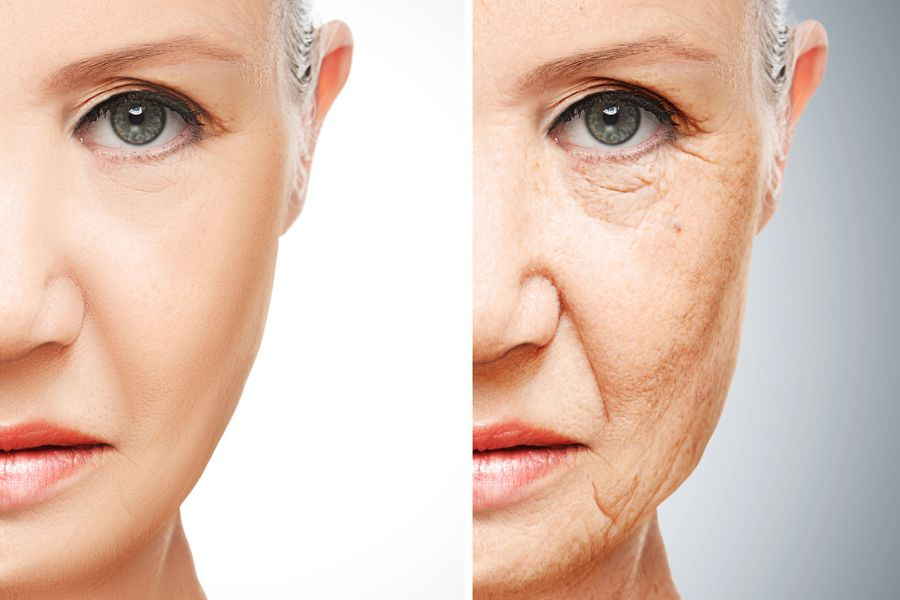Ozempic Face: From Diabetes Drug to Weight Loss Craze